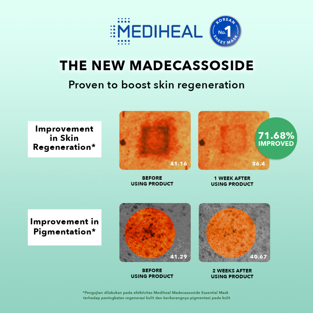 Mediheal Essential Mask - Madecassoside Soothing (Tosca)