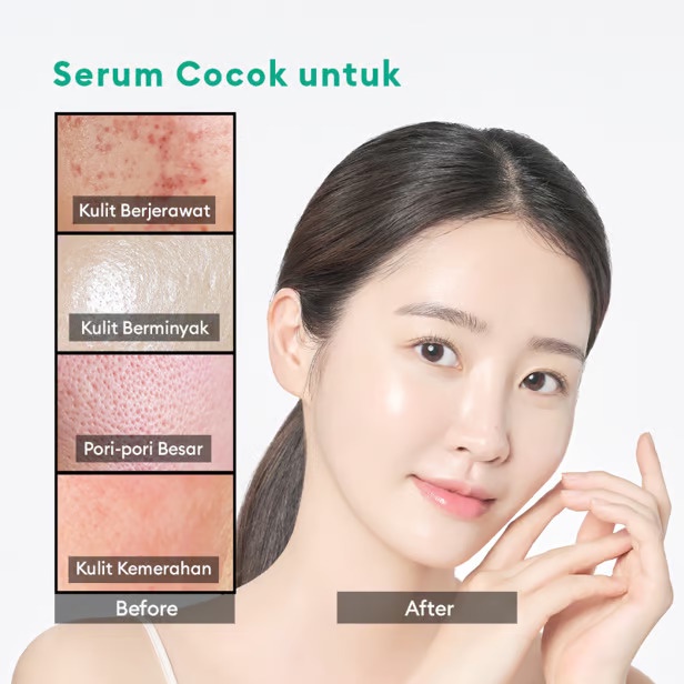 ARIUL 7Days Acne Clearing Serum 20ml