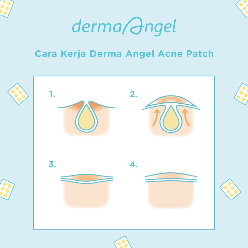 DERMA ANGEL Acne Patch Day 6s (Pagi)