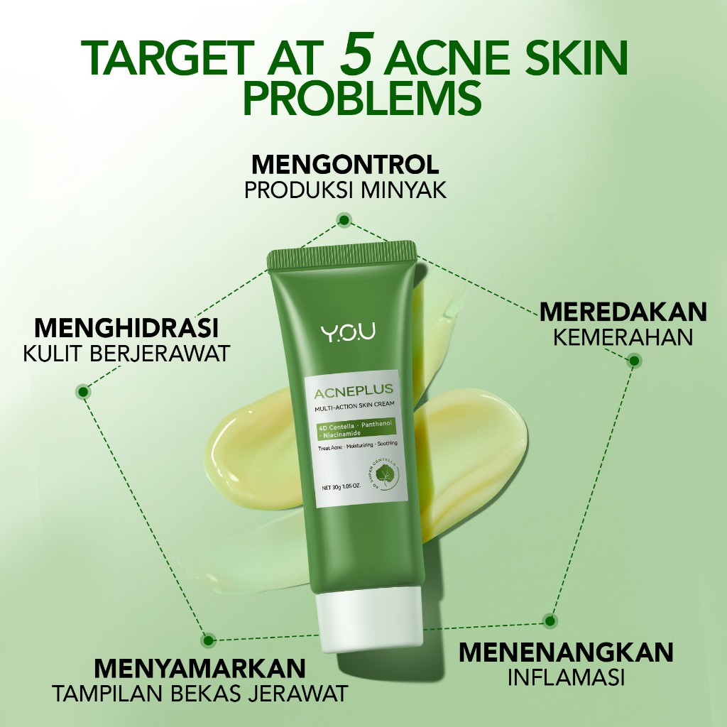 YOU Acneplus Multi Action Skin Cream 30gr