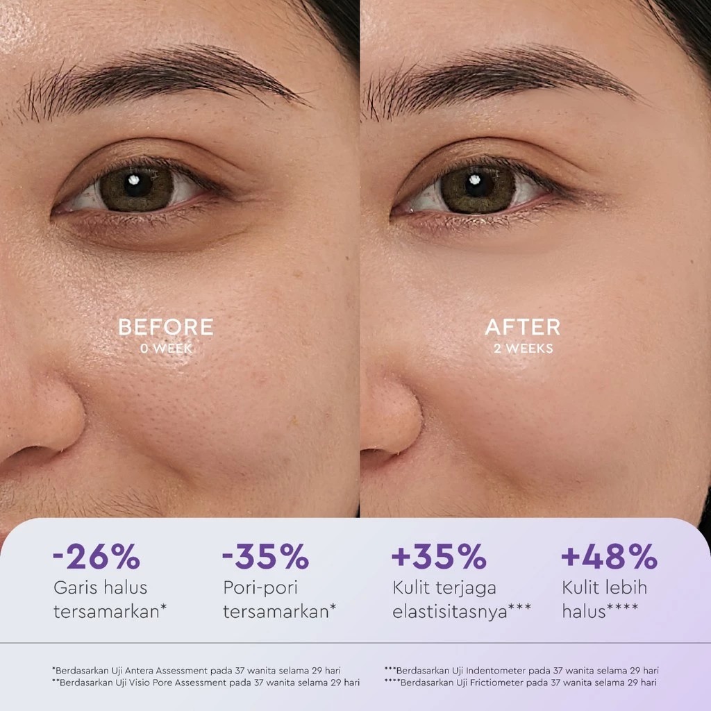 Wardah Renew You 1% Retinol Microcapsule  Ceramide Cell Renewal Serum 15ml
