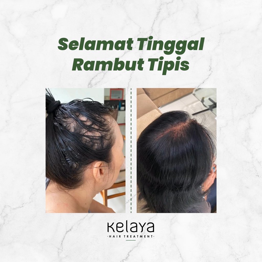Kelaya Hair Treatment Shampoo 250ml - Minyak Kemiri & Extract Aloevera