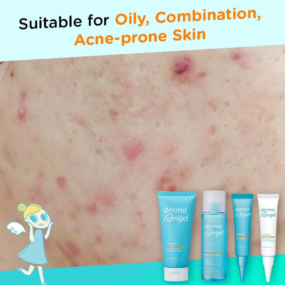 Derma Angel Acne Care Post-Acne Spot Lightening Serum 10ml