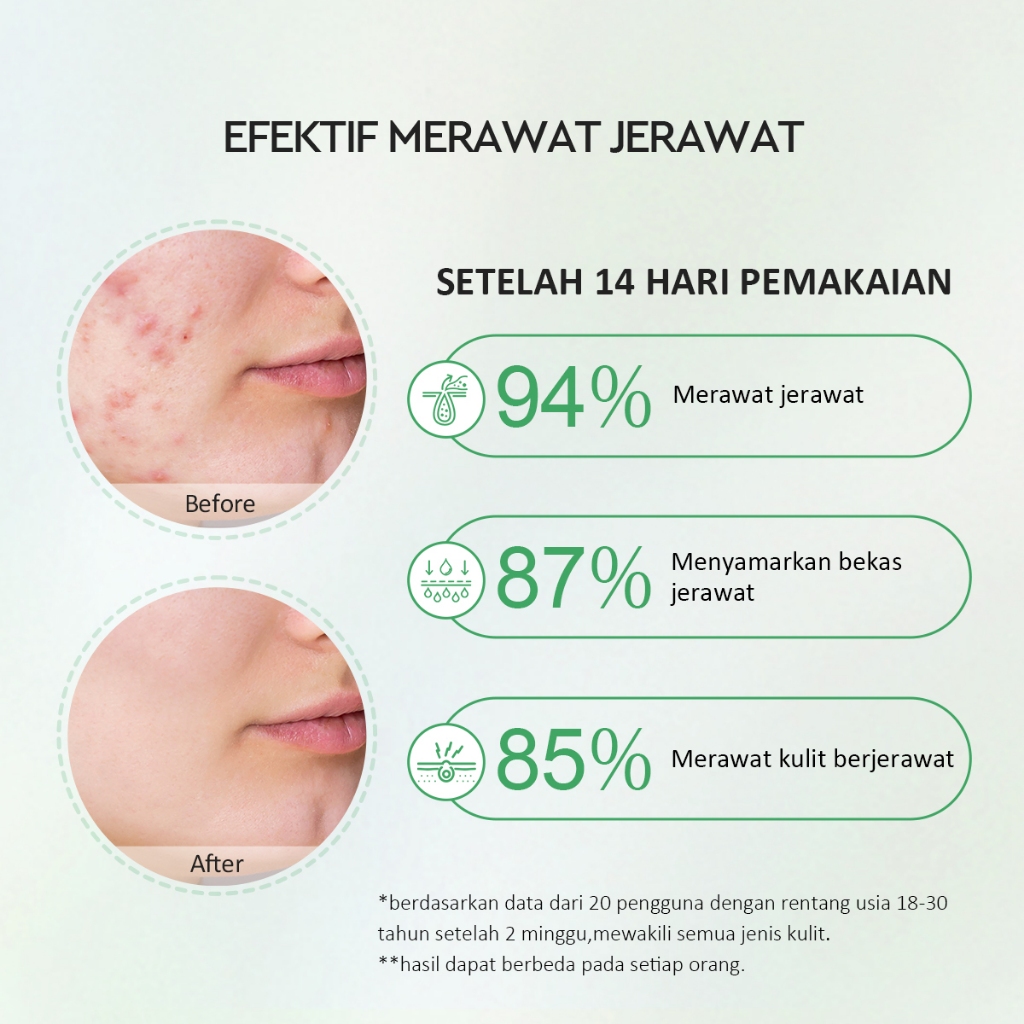 Glad 2 Glow Serum - Centella 2% Salicylic Acid Acne 17ml