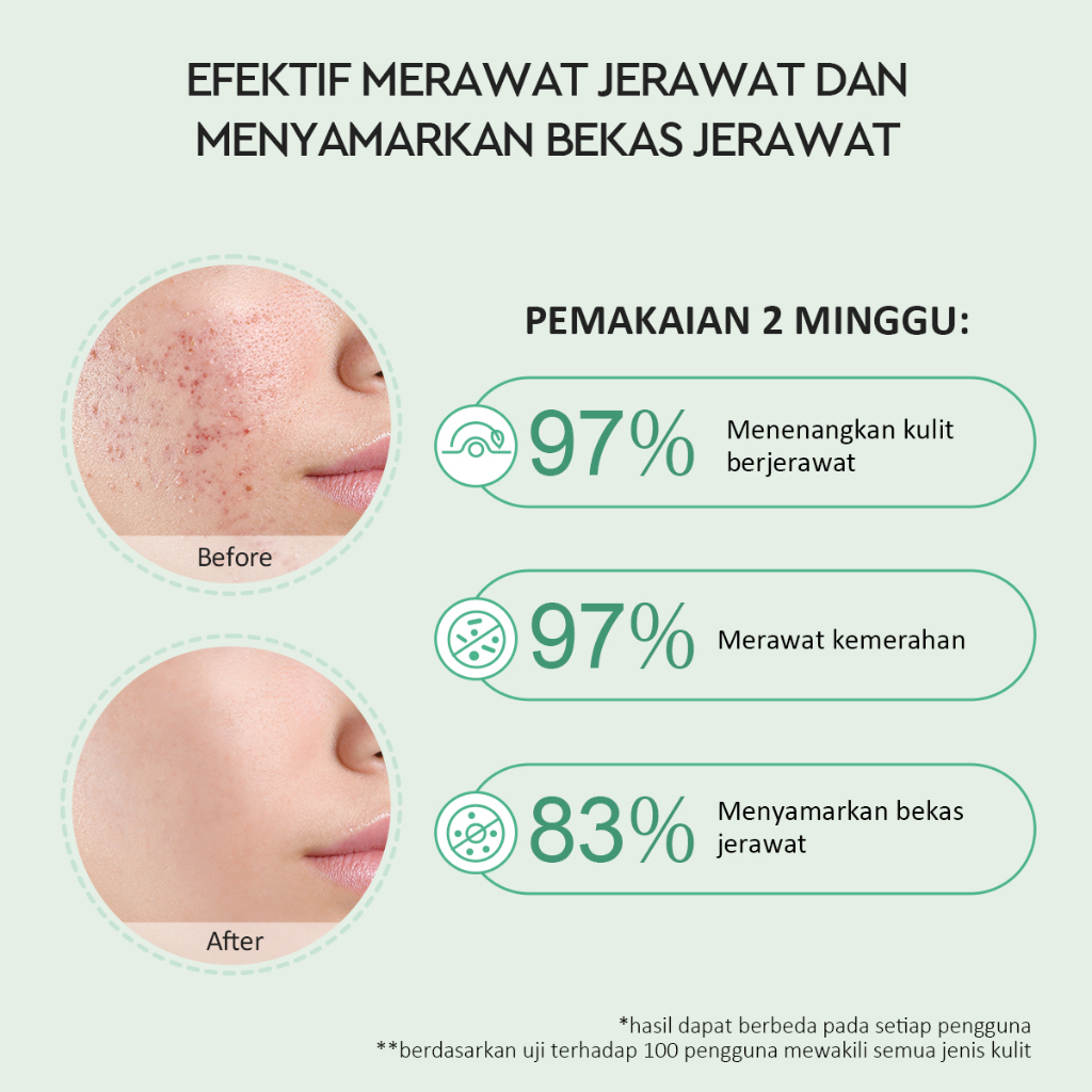 Glad 2 Glow 2% Salicylic Acid Acne Spot 5gr