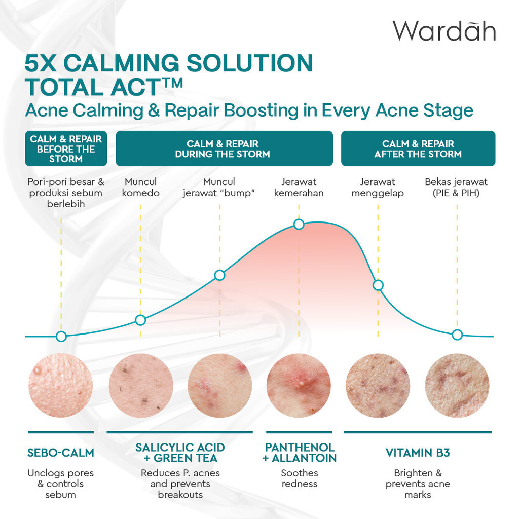 Wardah UV Shield Acne Calming Sunscreen Serum SPF50 PA++++ 25ml
