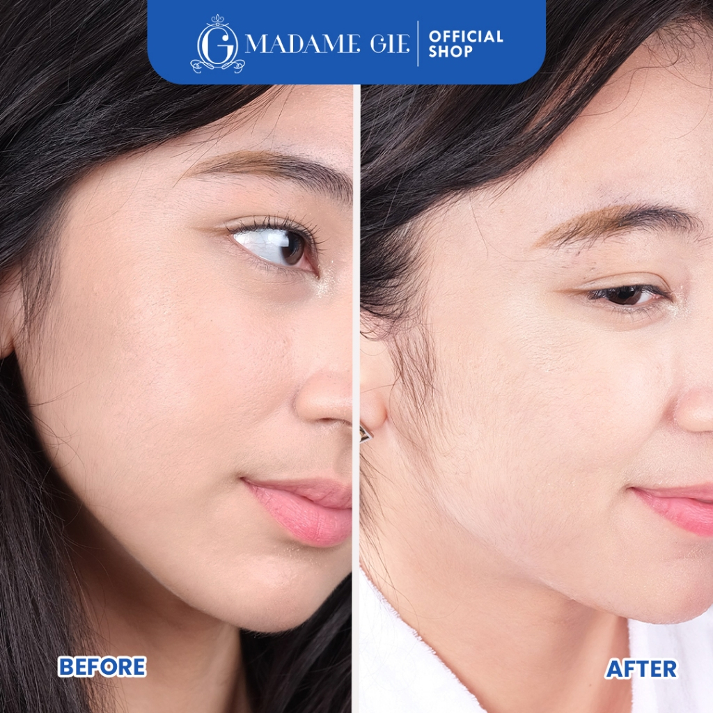 Madame Gie Necessity Sheet Mask 25ml - Glutaniacin (Bright)