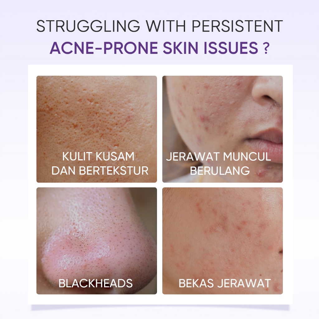 Skintific Lactic Acid Skin Renewal Exfoliating Serum 20ml