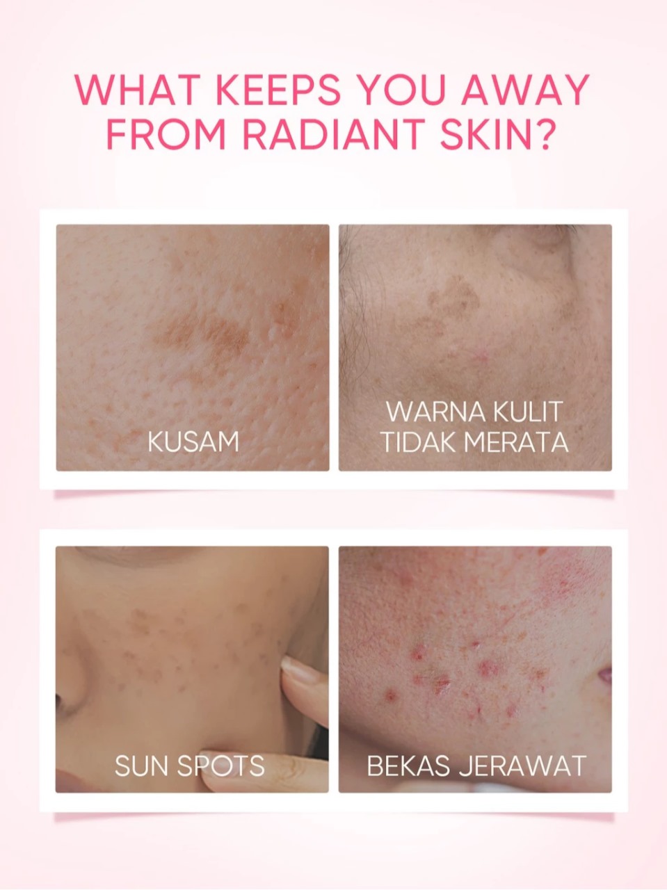 Skintific MSH Niacinamide Brightening Moisturizer 80gr