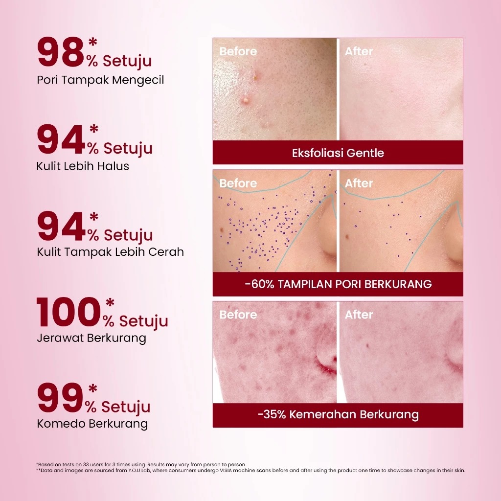 YOU 6% Acid Renewal Peeling Serum 20ml