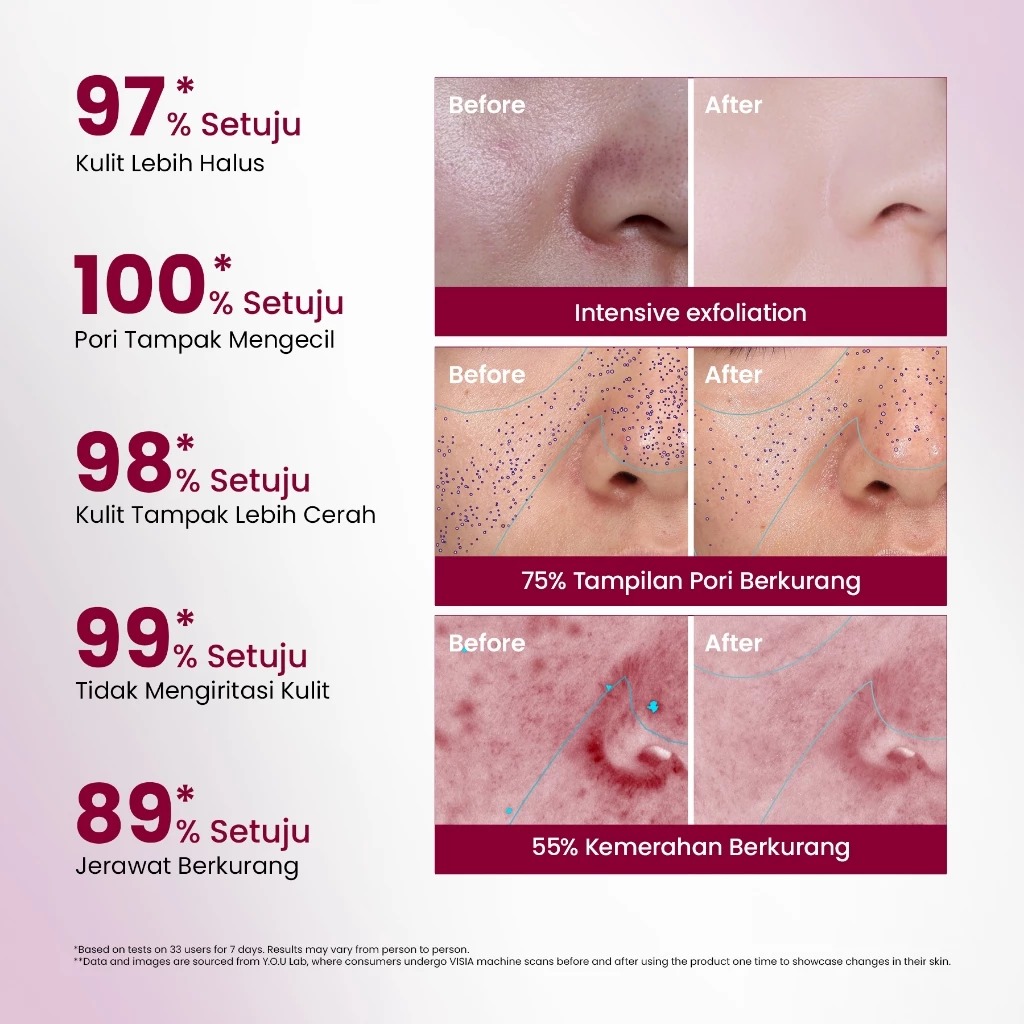 YOU 12% Acid Intensive Peeling Serum 20ml