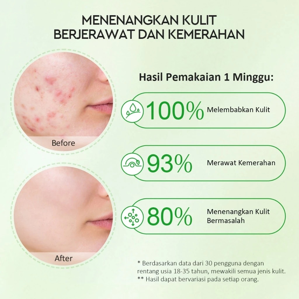 Glad 2 Glow Moisturizer - Centella Allantoin Soothing Gel 100gr