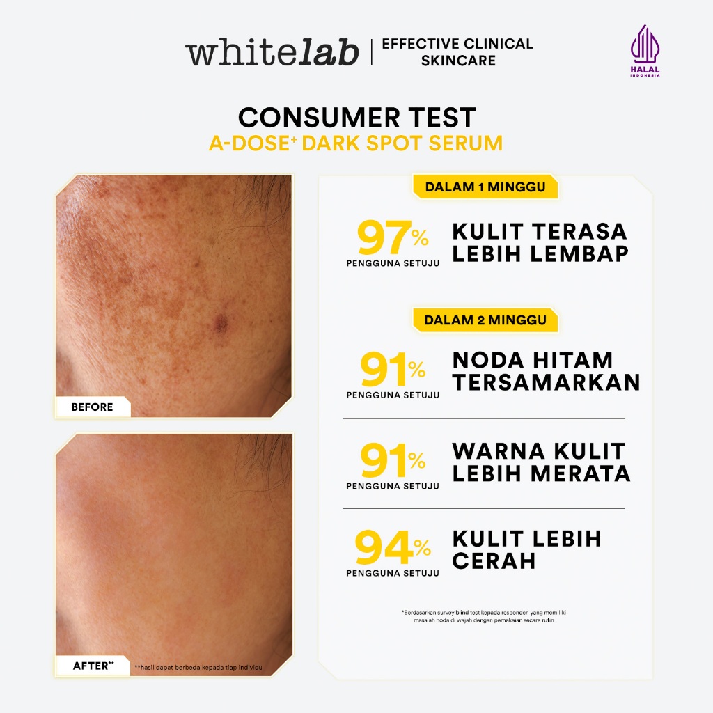 WHITELAB A-Dose+ Dark Spot Serum 20ml