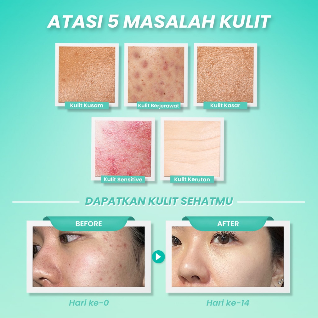Hanasui Ceramide Probiotics Peeling Gel 100gr